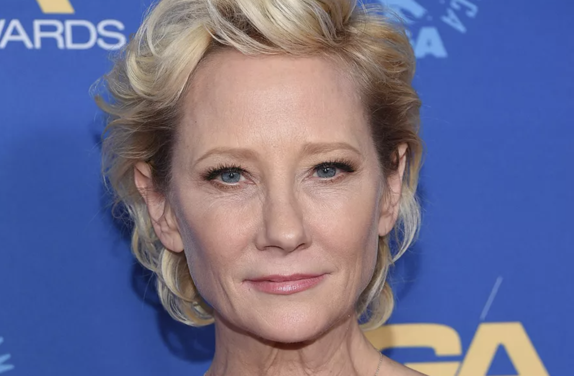 Anne Heche, Dead at 53